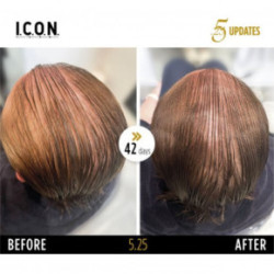 I.C.O.N. 5.25 Hair Growth Replenisher Serums pret matu izkrišanu 100ml