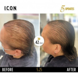 I.C.O.N. 5.25 Hair Growth Replenisher Serums pret matu izkrišanu 100ml