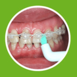 ApaCare Sonic 3D Sensitive Single Tuft Toothbrush Heads Viena zobu birstes uzgaļi 2vnt