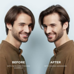 Nioxin Diaboost Xtrafusion Treatment for Thinning Hair Līdzeklis matu stiprināšanai 100ml