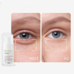 Skinlovers 4’E Anti-Puff & Wrinkle Eye Cream Intensīvi atjaunojošs krēms zonai zem acīm 15 ml