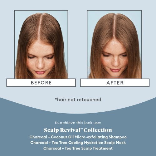 Briogeo Scalp Revival Scalp Soothing Solutions Set Komplekts problemātiskai galvas ādai