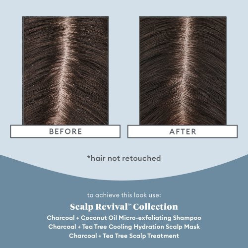 Briogeo Scalp Revival Scalp Soothing Solutions Set Komplekts problemātiskai galvas ādai